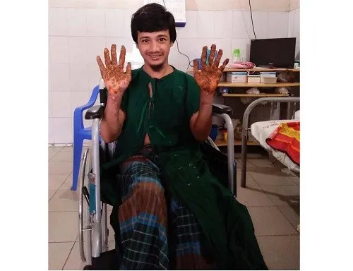 আবারো ড্রেসিং হয়েছে ‘বৃক্ষমানব’র হাতে