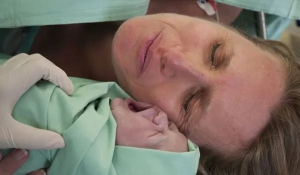 caesarean