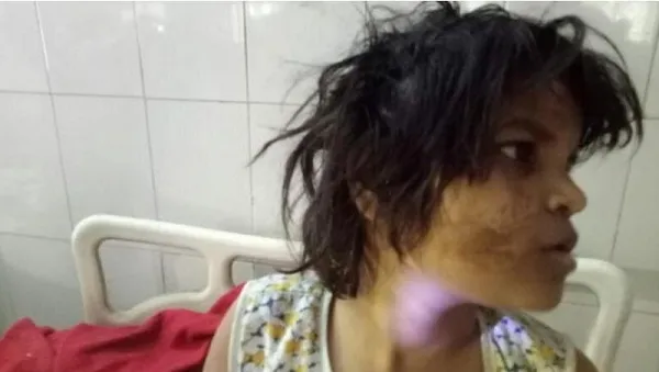 ভারতের জঙ্গলে বানর সাম্রাজ্যে ৮ বছরের ‘মুগলি’র সন্ধান