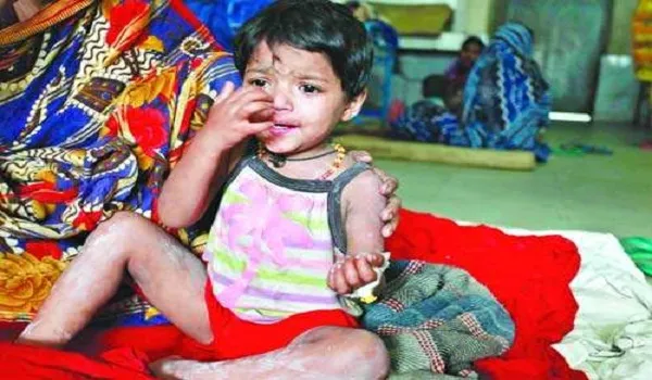 ডায়রিয়া ও চর্মরোগে আক্রান্ত হচ্ছে হাওরাঞ্চলের মানুষ