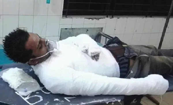 কেন গায়ে আগুন দিলেন বিশ্ববিদ্যালয় শিক্ষার্থী