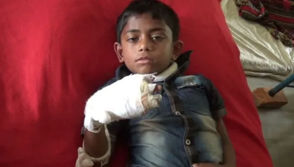 বাঁধে খেলা করার অপরাধে শিশুর চার আঙুল কাটার অভিযোগ