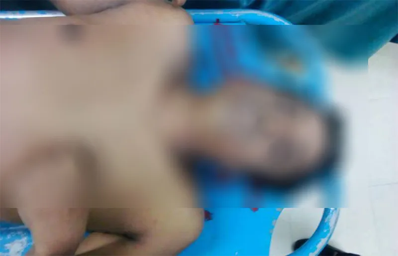 কক্সবাজারে হোটেল থেকে ‘আইওএম’ কর্মকর্তার মৃতদেহ উদ্ধার