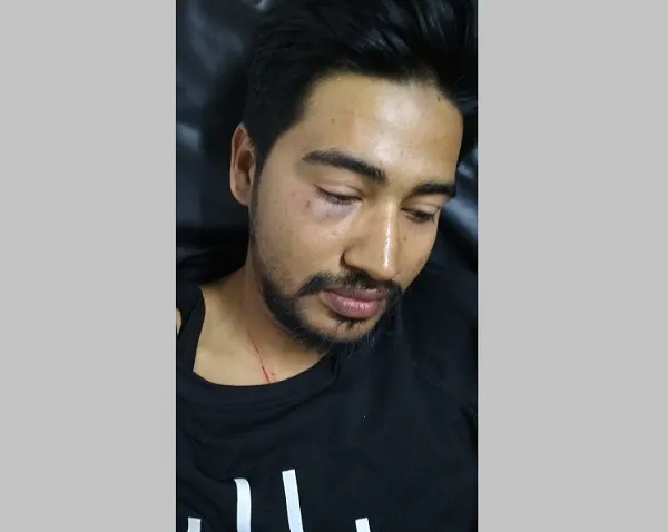 জগন্নাথ বিশ্ববিদ্যালয়ের শিক্ষার্থীকে পেটালো পরিবহন শ্রমিকরা
