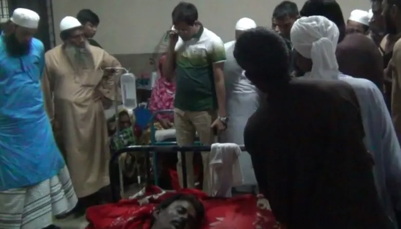 পানির বদলে এসিড খাওয়ানোর অভিযোগ