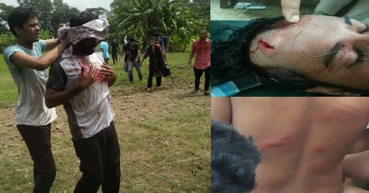 গোপালগঞ্জে শিক্ষার্থীদের ওপর ‌‘উপাচার্যের গুণ্ডাবাহিনী’র হামলা