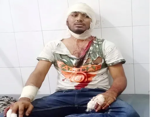 কানের বদলে কাটা হলো কান