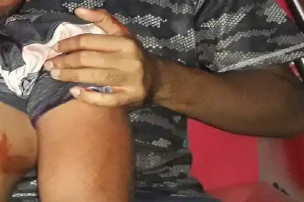 ছিনতাইকারীর ছুরিকাঘাতে রাবি শিক্ষার্থী গুরুতর আহত