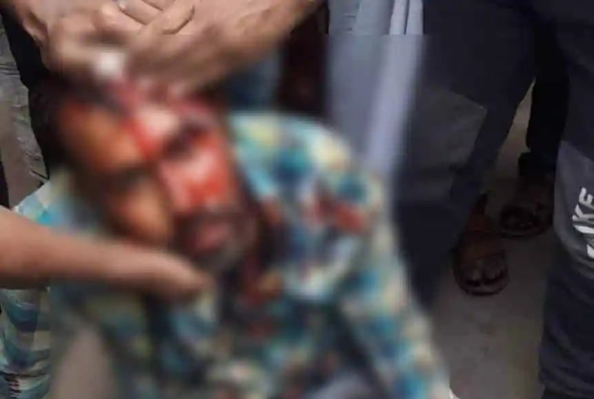 অস্ত্রধারীদের হামলায় সাংবাদিক আহত, রামদা কোপে ক্ষত. Channel i News - চ্যানেল আই নিউজ