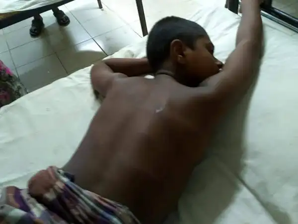 মাদ্রাসা শিক্ষার্থী হাসপাতালে ভর্তি, আহত অবস্থায় শোয়া. Channel i News - চ্যানেল আই নিউজ