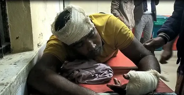 আহত ব্যক্তি হাসপাতালে চিকিৎসাধীন, নির্বাচনী সহিংসতার ছবি. Channel i News - চ্যানেল আই নিউজ