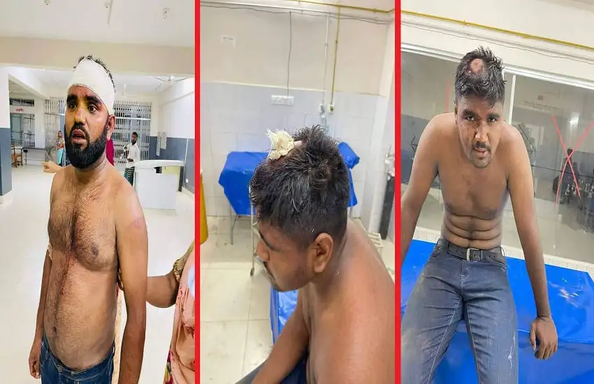 তিন ভাই কুপিয়ে জখমের ছবি, আহত ব্যক্তিরা হাসপাতালে চিকিৎসাধীন. Channel i News - চ্যানেল আই নিউজ