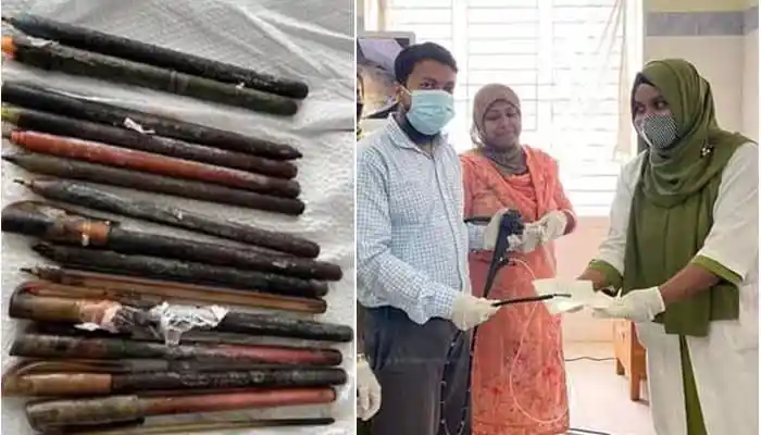 রোগীর পেট থেকে বের হওয়া ১৫টি কলমের ছবি, চিকিৎসা প্রক্রিয়া দেখানো হচ্ছে. Channel i News - চ্যানেল আই নিউজ