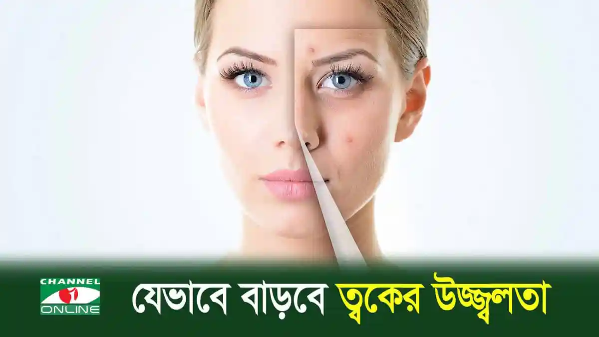অর্ধেক মুখের ছবি, এক পাশে ত্বকের সমস্যা, অন্য পাশে সুস্থ ত্বক. Channel i News - চ্যানেল আই নিউজ