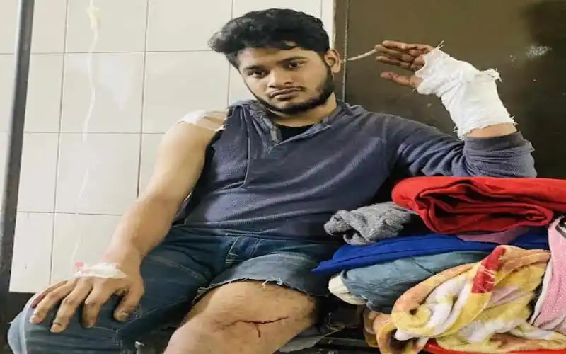 আহত ছাত্রের ছবি, তার হাতে ও পায়ে ক্ষত চিহ্ন দেখা যাচ্ছে. Channel i News - চ্যানেল আই নিউজ