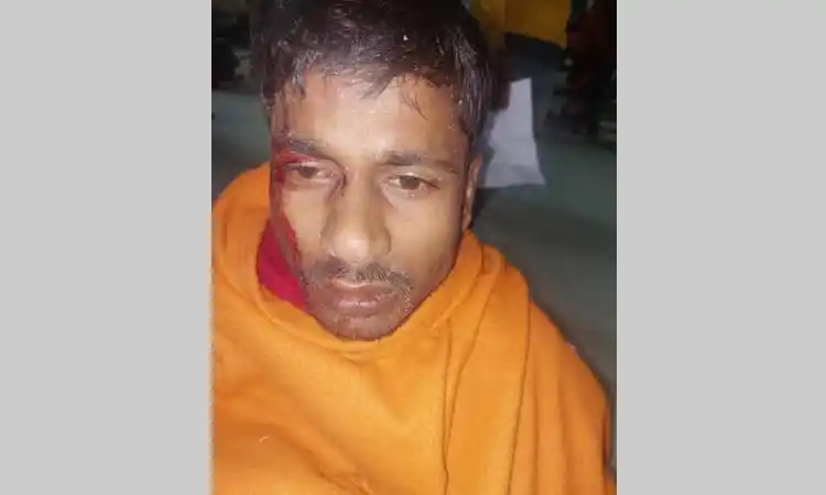 নিহত শ্রমিকের আহত মুখ ও চোখের চিহ্ন দেখা যাচ্ছে. Channel i News - চ্যানেল আই নিউজ