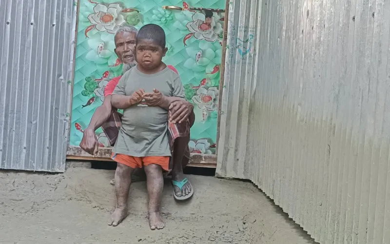 দুর্বল শিশু ও বৃদ্ধের ছবি, Bangladesh, poverty, children. Channel i News - চ্যানেল আই নিউজ