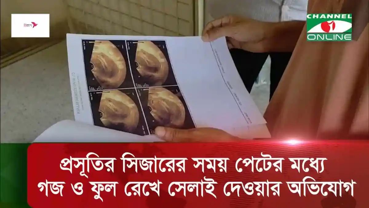 দিনাজপুরে এক প্রসূতির সিজারের সময় পেটের মধ্যে গজ ও ফুল রেখে সেলাই দেওয়ার অভিযোগ