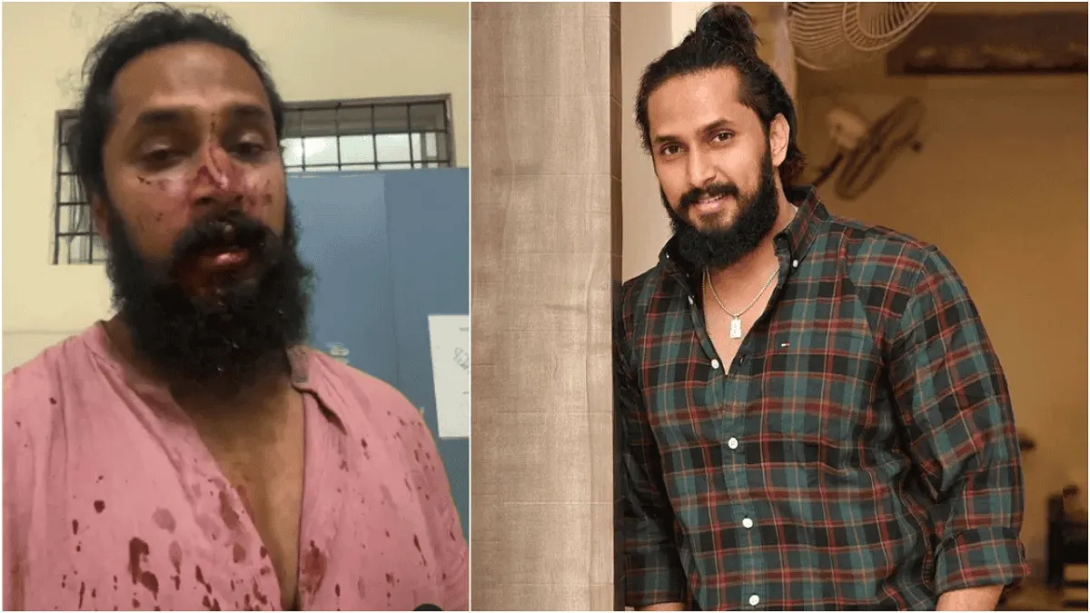অভিনেতা মারধরের শিকার, আহত অবস্থায় হাসপাতালে ভর্তি. Channel i News - চ্যানেল আই নিউজ