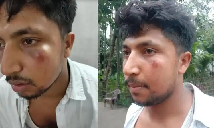 আঘাতপ্রাপ্ত যুবকের মুখে আঘাতের চিহ্ন, আহতের ছবি. Channel i News - চ্যানেল আই নিউজ