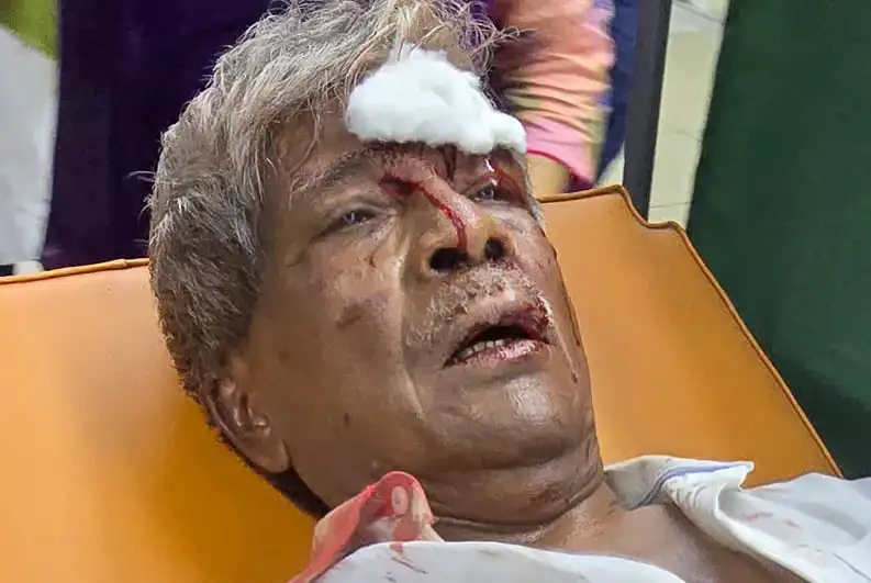 অধ্যাপক আনোয়ার হোসেনের মাথায় আঘাতের চিহ্ন, হাসপাতালে ভর্তি. Channel i News - চ্যানেল আই নিউজ