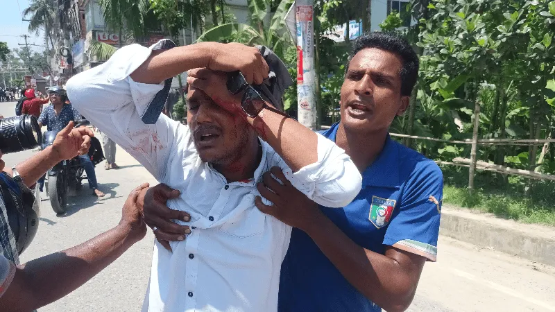চাকমা আহত ব্যক্তির চিকিৎসার জন্য উদ্ধারকর্মীরা কাজ করছে. Channel i News - চ্যানেল আই নিউজ