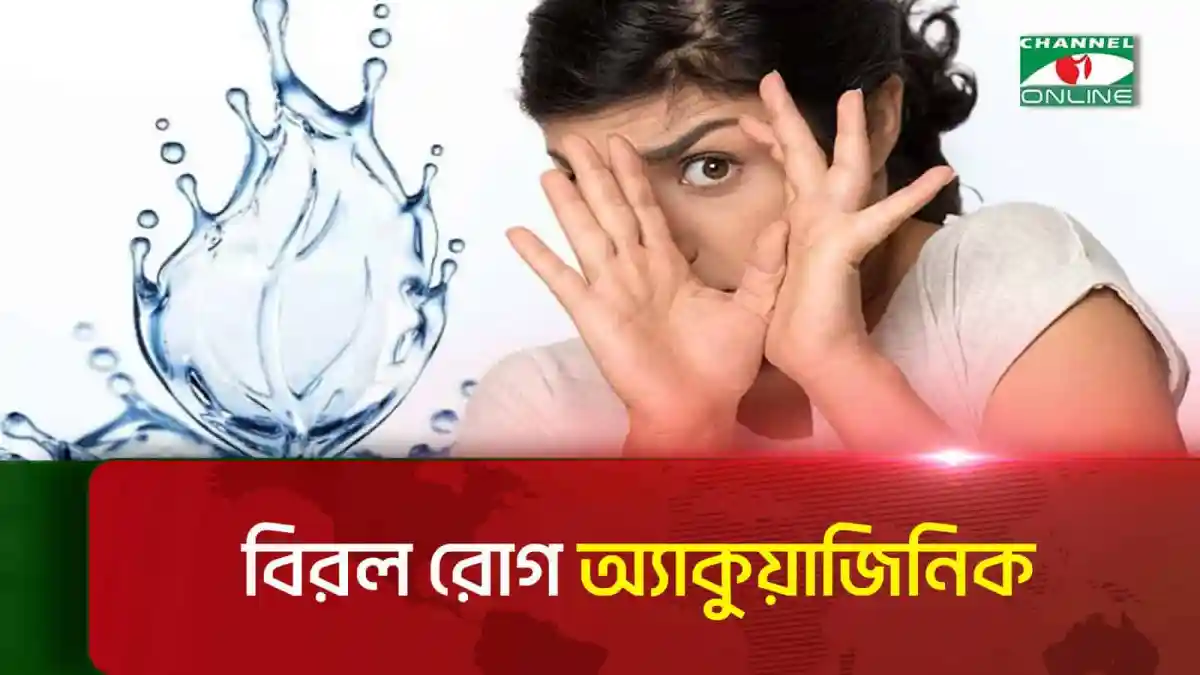 পানি থেকে অ্যালার্জি হওয়ার লক্ষণ দেখাচ্ছে একজন নারী. Channel i News - চ্যানেল আই নিউজ