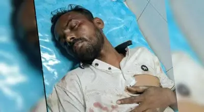 হিরো আলম হাসপাতালে ভর্তি, আহত অবস্থায় শুয়ে আছেন. Channel i News - চ্যানেল আই নিউজ
