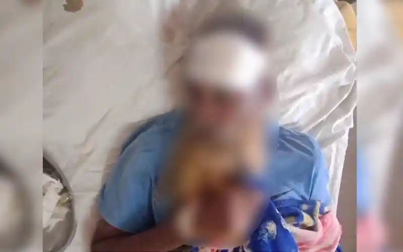 আঘাতপ্রাপ্ত ব্যক্তি হাসপাতালে চিকিৎসাধীন অবস্থায়।. Channel i News - চ্যানেল আই নিউজ
