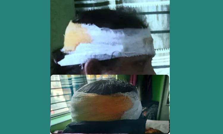 গণসংযোগকালে নেত্রীকে কুপিয়ে জখম: জামায়াত