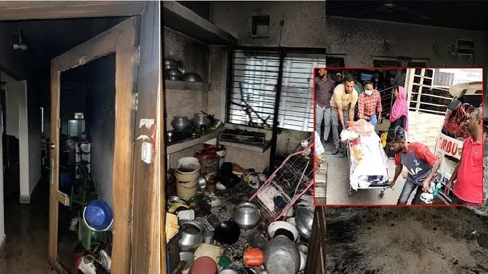 অগ্নিদগ্ধ শৈশব: পোড়া শরীরে ‘আম্মু’কে খুঁজে ফিরছে আনাস