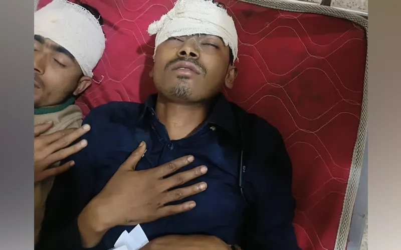নোয়াখালীর হাতিয়ায় বিটিভির সাংবাদিককে কুপিয়ে জখম