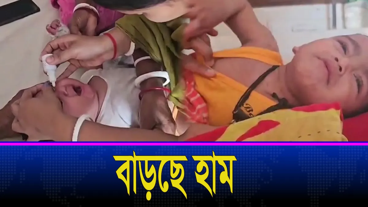 দেশের বিভিন্ন অঞ্চলে হামের প্রাদুর্ভাব বাড়ছে