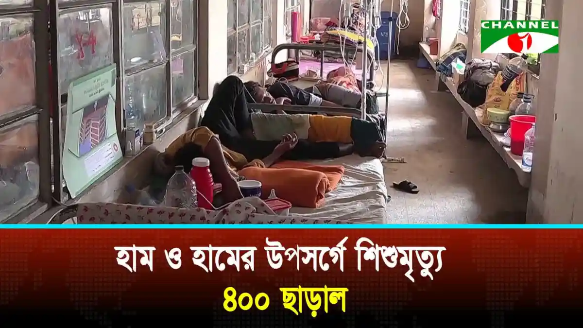 শিশুদের হামে আক্রান্তের জন্য হাসপাতালে বিশ্রামরত শিশু ও তাদের মা. Channel i News - চ্যানেল আই নিউজ