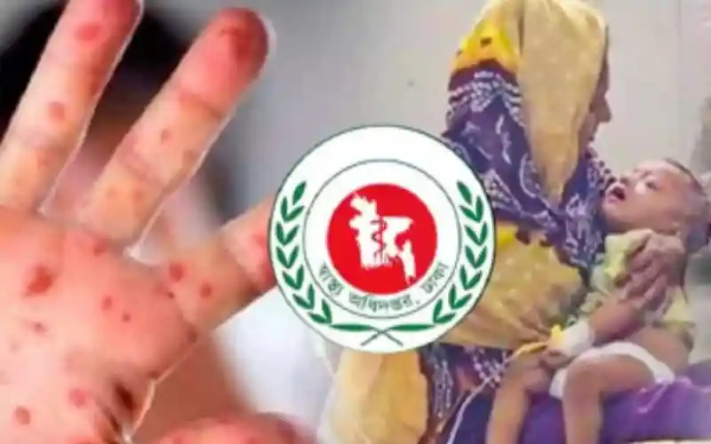 চিকিৎসা কেন্দ্রের ছবি যেখানে শিশুরা রোগে আক্রান্ত. Channel i News - চ্যানেল আই নিউজ