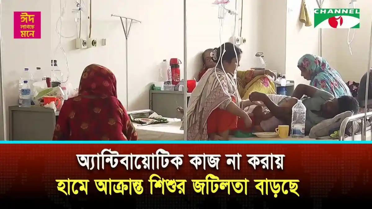 হামে আক্রান্ত শিশুর চিকিৎসা চলাকালে নার্স ও পরিবারের সদস্যরা. Channel i News - চ্যানেল আই নিউজ