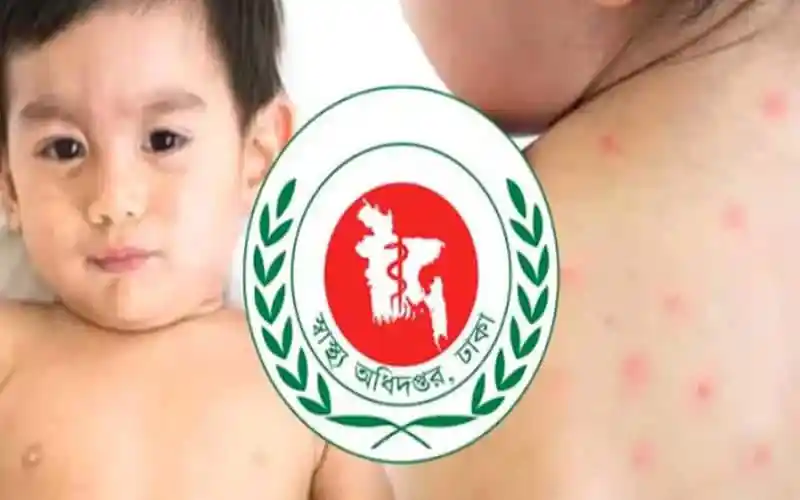 চিকিৎসা সংক্রান্ত সচেতনতামূলক ছবি, শিশুদের চর্মরোগের লক্ষণ দেখানো. Channel i News - চ্যানেল আই নিউজ