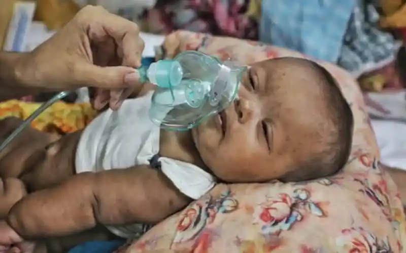 শিশু রোগীর জন্য অক্সিজেন মাস্ক ব্যবহার করছে একজন স্বাস্থ্যকর্মী. Channel i News - চ্যানেল আই নিউজ