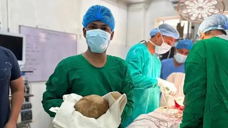 চিকিৎসকরা অপারেশনের সময় পাথর সহ রোগীর মূত্রথলি দেখছেন।. Channel i News - চ্যানেল আই নিউজ
