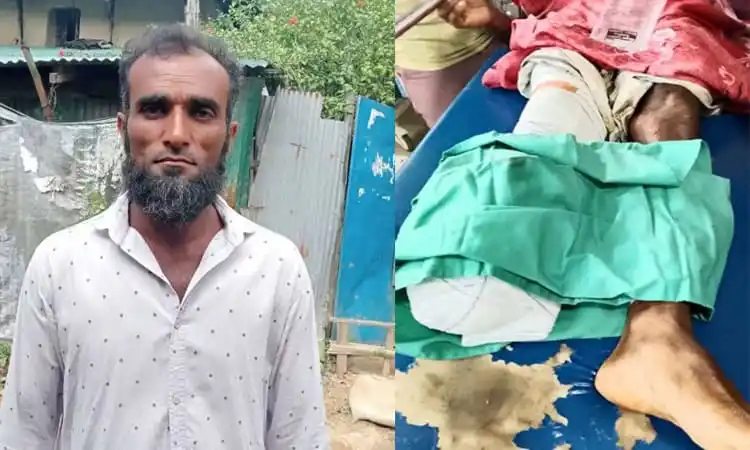 উখিয়ায় মাইন বিস্ফোরণে আহত বাংলাদেশি ব্যক্তি ও আহতের পা. Channel i News - চ্যানেল আই নিউজ