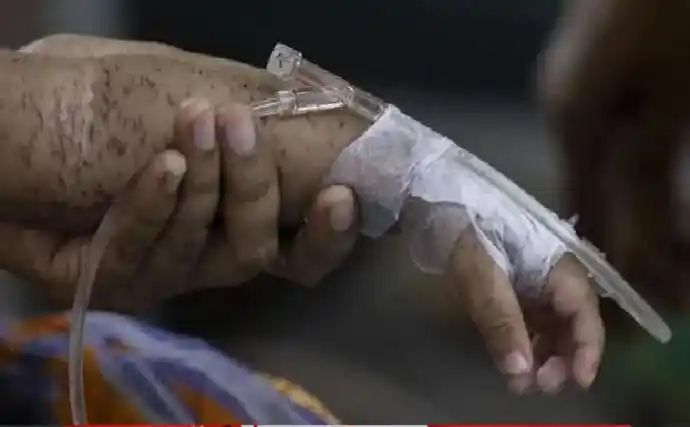 হাম ও উপসর্গ নিয়ে বাংলাদেশে শিশু মৃত্যু এক হাজার ছাড়াল