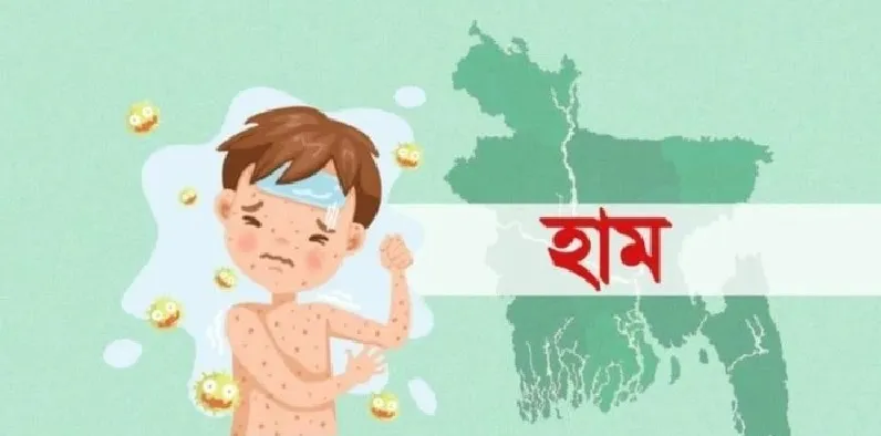বাংলাদেশে হামের ভয়াবহ প্রাদুর্ভাব, বিশ্বজুড়ে সতর্কবার্তা