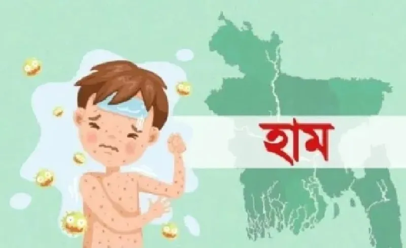 ২৪ ঘণ্টায় হামে আরও ৩ শিশুর মৃত্যু